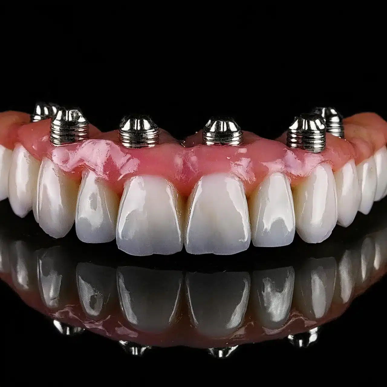 Full Arch Replacement
