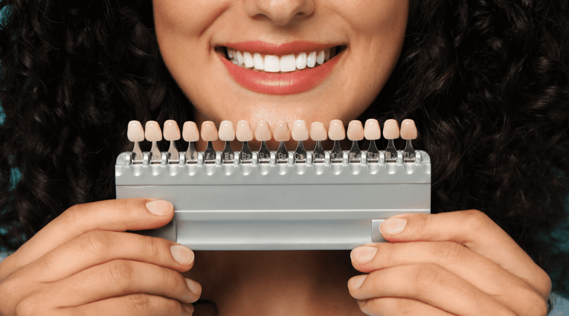 Porcelain Veneers