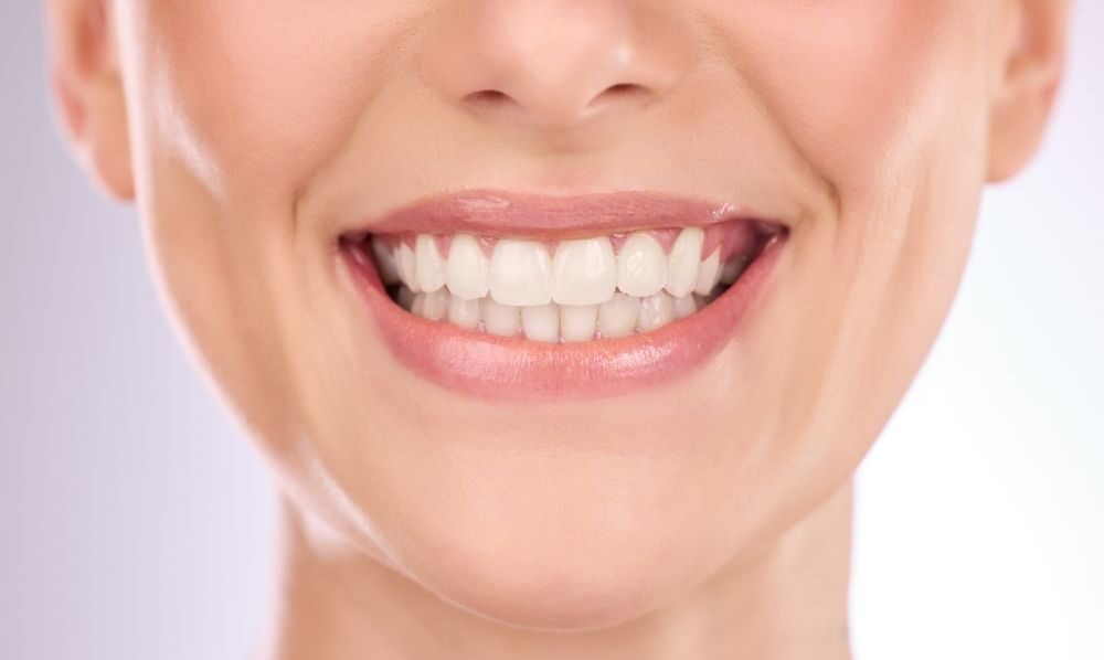 Teeth Whitening